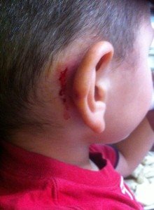 בן ה-4 אשר נפצע בתאונה. צילום: יעל בן-שלום