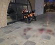 אשדוד: בן 16 נפצע בינוני משברי זכוכית