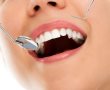 טיפים שכדאי לדעת לפני הלבנת שיניים