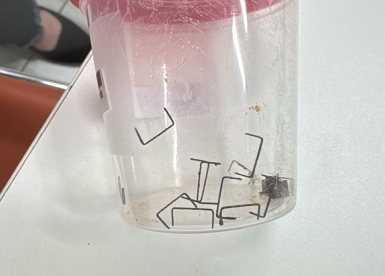 סיכות המהדק שהוצאו מהוושט של התינוק 